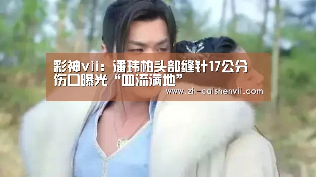 彩神vii:潘玮柏头部缝针17公分 伤口曝光“血流满地”(图2) 彩神vii