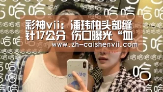 彩神vii:潘玮柏头部缝针17公分 伤口曝光“血流满地”(图4) 彩神vii